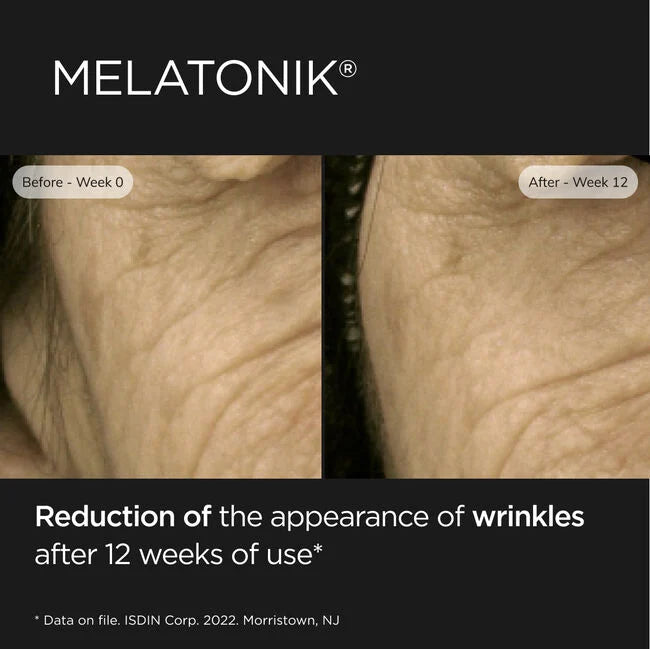 ISDIN Melatonik before-and-after neck wrinkles results after 12 weeks
