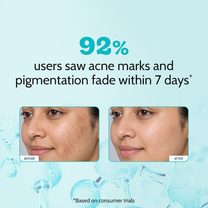 10% Niacinamide Clarifying Face Serum for Hyperpigmentation & Dark Spots - 30 ml