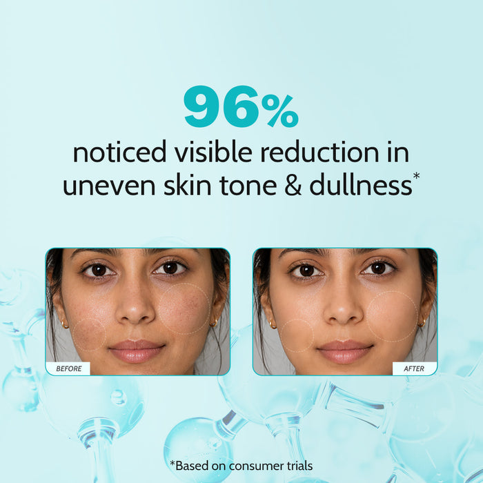 10% Niacinamide Clarifying Face Serum for Hyperpigmentation & Dark Spots - 30 ml