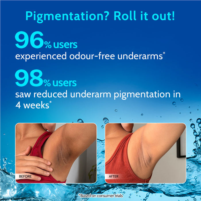5% AHA Underarm Roll On for Odour Control & Pigmentation (Woody Musk) - 40 ml