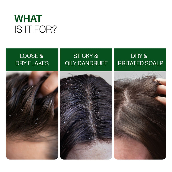 Advanced Anti-Dandruff Serum  With Defenscalp™, Salicylic Acid & Pentavitin - 50 ml