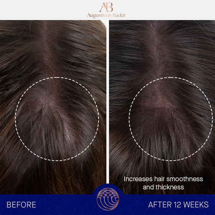 Before and after 12 weeks showing fuller, smoother hair and scalp with Augustinus Bader hair oil