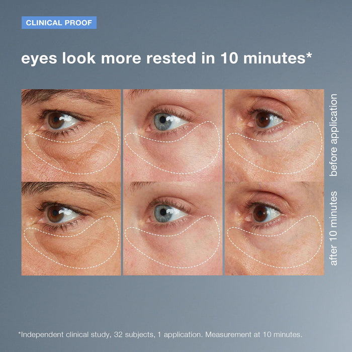 awaken peptide depuffing eye gel before and after
