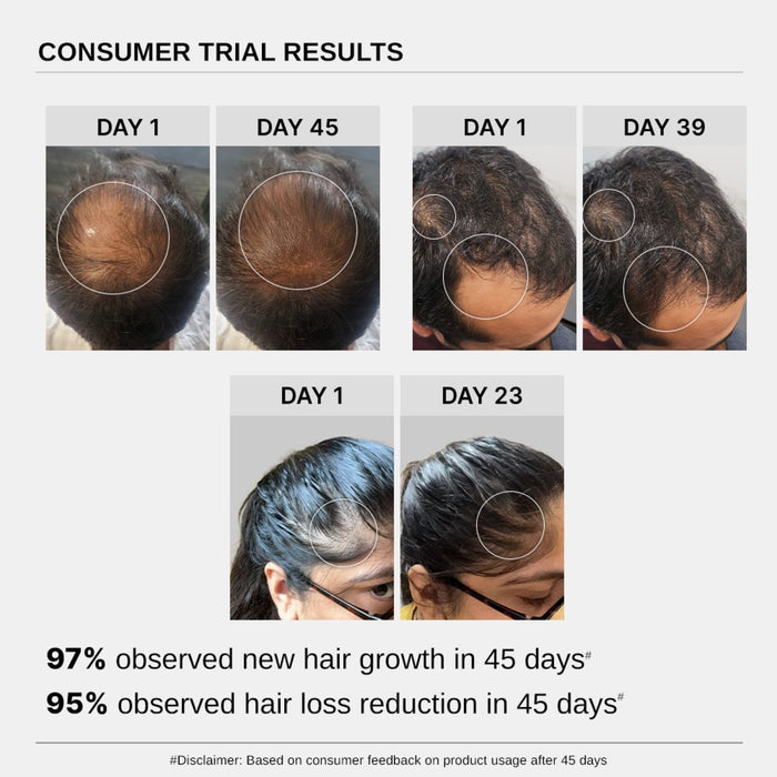 Hair Growth Serum (30 ml | Pack of 2) & Scalp Massager Hair Growth Combo
