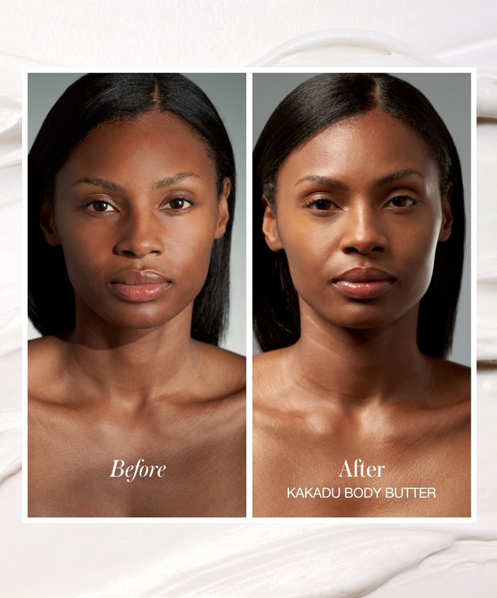 Before and after comparison of a woman’s face showcasing the moisturizing and nourishing effects of Kakadu Body Butter on her skin.