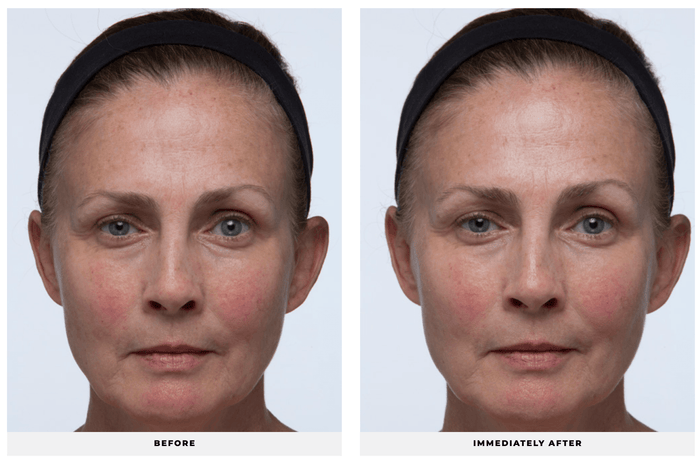 Ultra Replenishing Sunscreen SPF 40 - CosMedical Technologies
